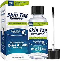 Skin tag remov for sale  Delivered anywhere in UK
