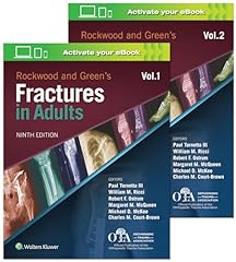 Rockwood green fractures for sale  Delivered anywhere in UK