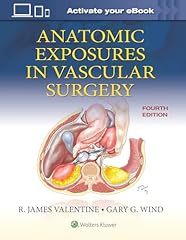 Anatomic exposures vascular for sale  Delivered anywhere in UK