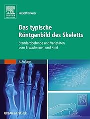 Typische röntgenbild skeletts gebraucht kaufen  Wird an jeden Ort in Deutschland