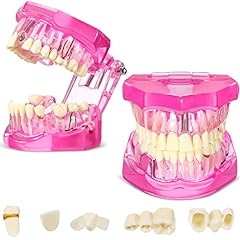 Outus disease teeth for sale  Delivered anywhere in USA 