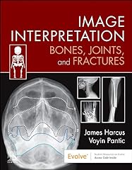 Image interpretation bones for sale  Delivered anywhere in Ireland