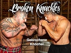 Gebrochene knöchel uk gebraucht kaufen  Wird an jeden Ort in Deutschland