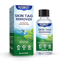 Skin tag removal for sale  Delivered anywhere in UK