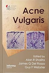 Acne vulgaris d'occasion  Livré partout en France