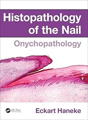 Histopathology nail onychopath for sale  Delivered anywhere in USA 