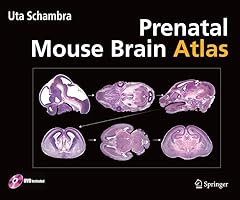 Prenatal mouse brain for sale  Delivered anywhere in USA 