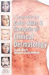 Fitzpatrick color atlas for sale  Delivered anywhere in USA 