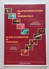 Blutuntersuchung dunkelfeld pr gebraucht kaufen  Wird an jeden Ort in Deutschland