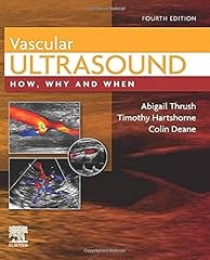 Vascular ultrasound how usato  Spedito ovunque in Italia 