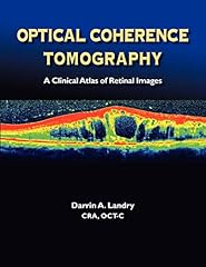 Optical coherence tomography for sale  Delivered anywhere in USA 
