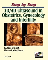Step step ultrasound for sale  Delivered anywhere in USA 