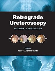 Retrograde ureteroscopy handbo for sale  Delivered anywhere in USA 