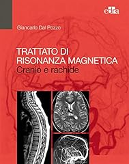 Risonanza magnetica cranio usato  Spedito ovunque in Italia 