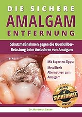 Sichere amalgam entfernung gebraucht kaufen  Wird an jeden Ort in Deutschland