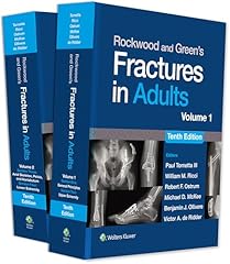 Rockwood green fractures for sale  Delivered anywhere in UK