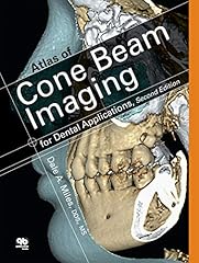 Atlas cone beam for sale  Delivered anywhere in USA 