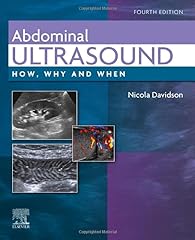 Abdominal ultrasound for sale  Delivered anywhere in Ireland