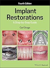 Implant restorations step for sale  Delivered anywhere in USA 