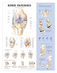 Knee injuries anatomical d'occasion  Livré partout en France