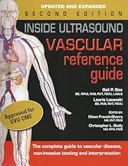 Inside ultrasound vascular for sale  Delivered anywhere in USA 
