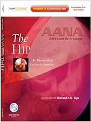 Aana advanced arthroscopy for sale  Delivered anywhere in USA 