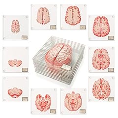 Anatomic brain specimen for sale  Delivered anywhere in UK