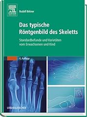 Typische röntgenbild skeletts gebraucht kaufen  Wird an jeden Ort in Deutschland
