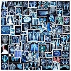 110pcs radiology ray for sale  Delivered anywhere in USA 