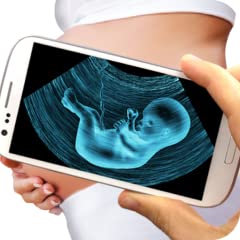 Ultrasound Scanner, used for sale  Delivered anywhere in Ireland