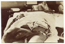 Medical photography elephantia d'occasion  Avignon