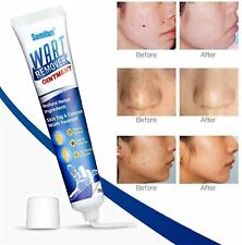 Sumifun wart removal for sale  ST. IVES