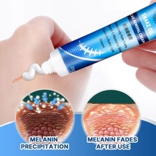 Healing scar cream for sale  CORBY