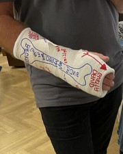 Massiver gipsarm safs gebraucht kaufen  Bochum