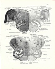 Usado, Stampa antica ANATOMIA del MIDOLLO medicina 1938 Antique print comprar usado  Enviando para Brazil