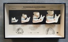 Schaukasten modell menschliche gebraucht kaufen  Zittau