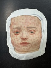 1922 antique medical for sale  Columbus