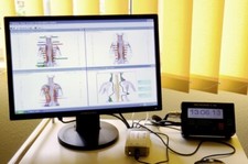 Chiropraktik diagnosetool lnsi gebraucht kaufen  Krefeld