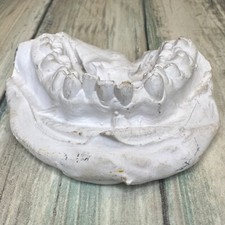 Vintage dental crooked for sale  New Holland