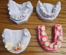 Dental schaumodell den gebraucht kaufen  Ottendorf-Okrilla
