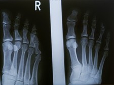 Riginal röntgenbilder röntge gebraucht kaufen Riginal röntgenbilder röntge gebraucht kaufen  Dresden