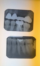 Dental ray films for sale  Brunswick