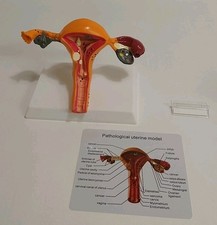 Modelo anatômico patológico de útero e ovário anatomia médica feminina humana comprar usado  Enviando para Brazil