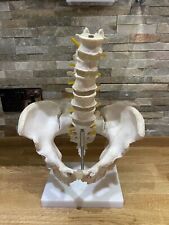Human lumbar vertebrae for sale  WESTCLIFF-ON-SEA