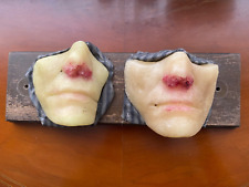 Antique medical moulage for sale  BLACKPOOL