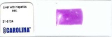 Human liver hepatitis for sale  Los Angeles
