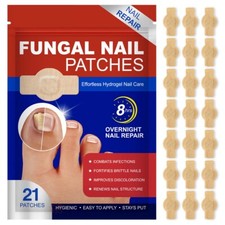 Anti fungal nail for sale  STOKE-ON-TRENT