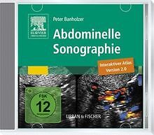Abdominelle sonographie intera gebraucht kaufen  Berlin