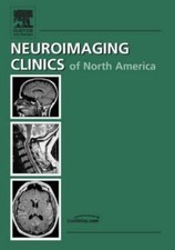 Intracranial Aneurysms, an Issue of Neuroimaging Clinics: Volume 16-3 comprar usado  Enviando para Brazil