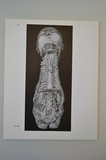 PLANCHE D'ANATOMIE HUMAINE SYSTEME NERVEUX ATLAS Dr SOBOTTA MEDECINE SCIENCE comprar usado  Enviando para Brazil